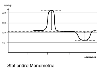 Analmanometrie